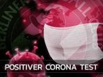 Corona: Positiver Test im Kader des BFC Dynamo